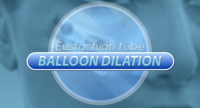 Eustachian Tube Balloon Dilation