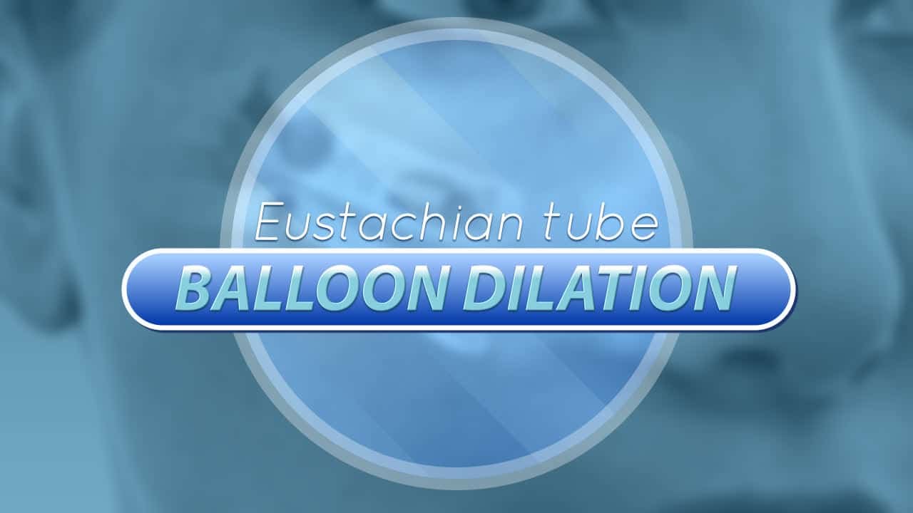 You are currently viewing Eustachian Tube Balloon Dilation