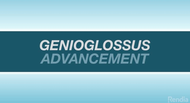 Genioglossus Advancement: Overview