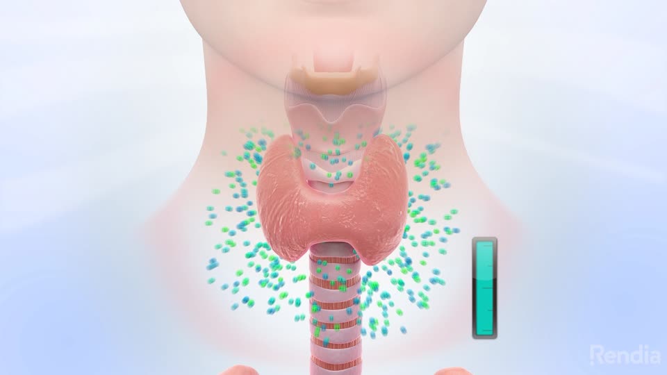 You are currently viewing Hyperthyroidism: Overview