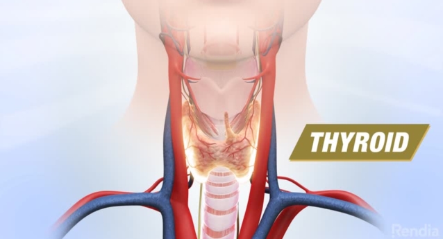 Thyroidectomy: Introduction To Surgery