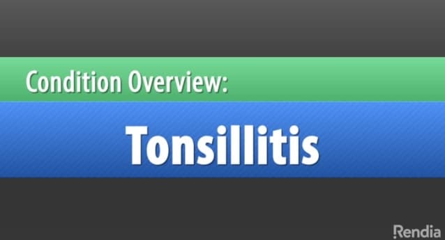 Vignette: What is Tonsillitis