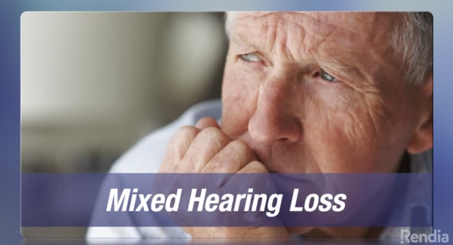 Hearing Loss: Mixed