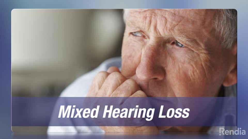 You are currently viewing Hearing Loss: Mixed