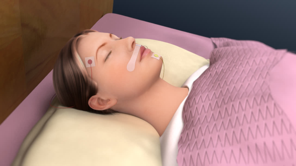 Sleep Study Introduction ENTJC