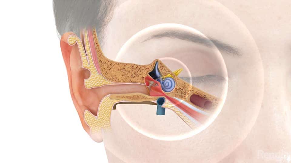 You are currently viewing Tinnitus: Overview